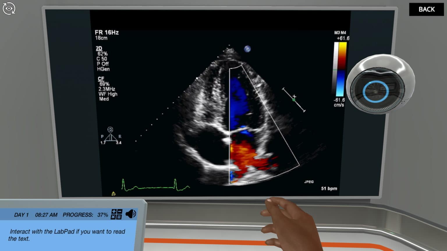 Introduction to Echocardiography Use different projections to diagnose