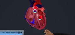 Introduction to Echocardiography