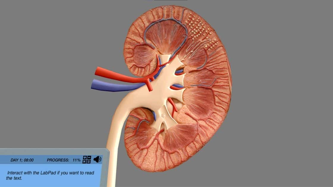 Treatment for Chronic Kidney Disease (NEW) Labster